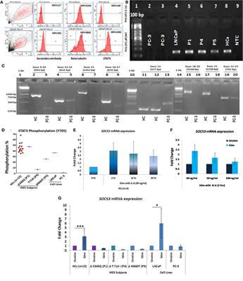 STAT3-Mediated Transcriptional Regulation of Osteopontin in STAT3 Loss-of-Function Related Hyper IgE Syndrome